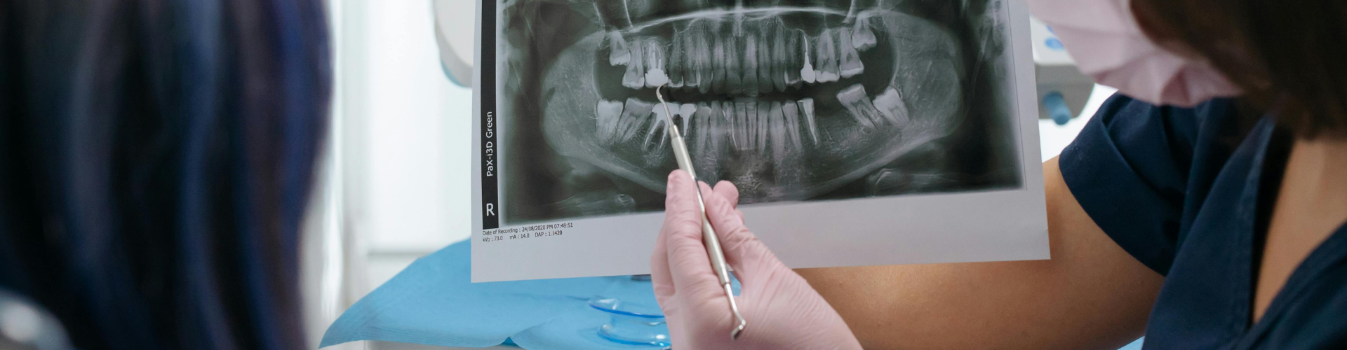Gloved hands holding a dental X-ray.